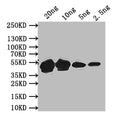 Western Blot
Positive WB detected in: recombinant protein
All lanes: MPS1 Antibody at 1:1000
Secondary
Goat polyclonal to rabbit IgG at 1/50000 dilution
Predicted band size: 47 kDa
Observed band size: 47 kDa
