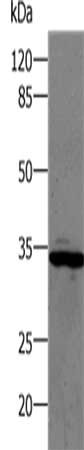 Gel: 10%SDS-PAGE, Lysate: 24 ug, Lane: Human lung cancer tissue, Primary antibody: CSB-PA348998(CA1 Antibody) at dilution 1/350, Secondary antibody: Goat anti rabbit IgG at 1/8000 dilution, Exposure time: 1 minute