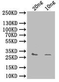 Western Blot
Positive WB detected in: recombinant protein
All lanes: yhaK Antibody at 1:1000
Secondary
Goat polyclonal to rabbit IgG at 1/50000 dilution
Predicted band size: 31 kDa
Observed band size: 31 kDa