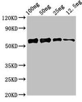 Western Blot
Positive WB detected in Recombinant protein
All lanes: ald1 antibody at 2.4ug/ml
Secondary
Goat polyclonal to rabbit IgG at 1/50000 dilution
predicted band size: 57 kDa
observed band size: 57 kDa