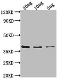 Western Blot
Positive WB detected in Recombinant protein
All lanes: hupB antibody at 1:2000
Secondary
Goat polyclonal to rabbit IgG at 1/50000 dilution
Predicted band size: 36 kDa
Observed band size: 36 kDa