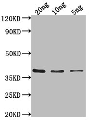 Western Blot
Positive WB detected in Recombinant protein
All lanes: hupB antibody at 1:2000
Secondary
Goat polyclonal to rabbit IgG at 1/50000 dilution
Predicted band size: 36 kDa
Observed band size: 36 kDa