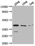 Western Blot
Positive WB detected in Recombinant protein
All lanes: ihfA antibody at 1:2000
Secondary
Goat polyclonal to rabbit IgG at 1/50000 dilution
Predicted band size: 38.1 kDa
Observed band size: 38 kDa
