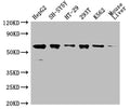 Western Blot
Positive WB detected in: HepG2 whole cell lysate,SH-SY5Y whole cell lysate,HT-29 whole cell lysate,293T whole cell lysate,K562 whole cell lysate,Mouse liver tissue 
All lanes: ERVFRD-1 antibody at 1:2000
Secondary
Goat polyclonal to rabbit IgG at 1/50000 dilution
Predicted band size: 60 kDa
Observed band size: 60 kDa