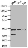 Western Blot
Positive WB detected in Recombinant protein
All lanes: gB antibody at 1:2000
Secondary
Goat polyclonal to rabbit IgG at 1/50000 dilution
Predicted band size: 43.3 kDa
Observed band size: 46 kDa