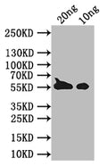 Western BlotPositive WB detected in Recombinant proteinAll lanes: BZLF1 antibody at 1:1000SecondaryGoat polyclonal to rabbit IgG at 1/50000 dilutionPredicted band size: 46 kDaObserved band size: 50 kDa