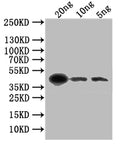 Western Blot
Positive WB detected in: recombinant protein
All lanes: gL Antibody at 1:1000
Secondary
Goat polyclonal to rabbit IgG at 1/50000 dilution
Predicted band size: 43 kDa
Observed band size: 43 kDa