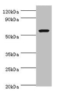Western blot
All lanes: AMY1A antibody at 7ug/ml + Rat heart tissue
Secondary
Goat polyclonal to rabbit IgG at 1/10000 dilution
Predicted band size: 58 kDa
Observed band size: 58 kDa