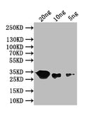 Western Blot
Positive WB detected in: recombinant protein
All lanes: recN Antibody at 1:1000
Secondary
Goat polyclonal to rabbit IgG at 1/50000 dilution
Predicted band size: 32 kDa
Observed band size: 32 kDa