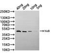 Western Blot
Positive WB detected in: recombinant protein
All lanes:hisB Antibody at 1:1000
Secondary
Goat polyclonal to rabbit IgG at 1/20000 dilution
Predicted band size: 41.5 kDa
Observed band size: 41.5 kDa