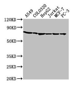 Western Blot
Positive WB detected in: A549 whole cell lysate, COLO320 whole cell lysate, HepG2 whole cell lysate, Jurkat whole cell lysate, MCF-7 whole cell lysate, PC-3 whole cell lysate
All lanes: HSPA1A antibody at 1:2000
Secondary
Goat polyclonal to rabbit IgG at 1/50000 dilution
Predicted band size: 71, 64 kDa
Observed band size: 71 kDa