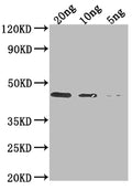 Western Blot
Positive WB detected in Recombinant protein
All lanes: DERP1 antibody at 1:2000
Secondary
Goat polyclonal to rabbit IgG at 1/50000 dilution
Predicted band size: 41 kDa
Observed band size: 41 kDa