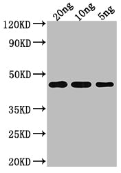 Western Blot
Positive WB detected in Recombinant protein
All lanes: TOXR antibody at 1:2000
Secondary
Goat polyclonal to rabbit IgG at 1/50000 dilution
Predicted band size: 44.21 kDa
Observed band size: 44 kDa
