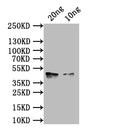 Western Blot
Positive WB detected in: recombinant protein
All lanes: hlgA Antibody at 1:1000
Secondary
Goat polyclonal to rabbit IgG at 1/50000 dilution
Predicted band size: 43 kDa
Observed band size: 43 kDa