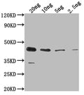 Western Blot
Positive WB detected in Recombinant protein
All lanes: ihfB antibody at 1:2000
Secondary
Goat polyclonal to rabbit IgG at 1/50000 dilution
Predicted band size: 38.5 kDa
Observed band size: 44 kDa
