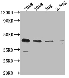 Western Blot
Positive WB detected in Recombinant protein
All lanes: ihfB antibody at 1:2000
Secondary
Goat polyclonal to rabbit IgG at 1/50000 dilution
Predicted band size: 38.5 kDa
Observed band size: 44 kDa