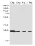 Western Blot
Positive WB detected in Recombinant protein
All lanes: ompX antibody at 1:2000
Secondary
Goat polyclonal to rabbit IgG at 1/50000 dilution
Predicted band size: 27 kDa
Observed band size: 27 kDa