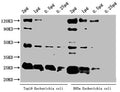 Western Blot
Positive WB detected in: Top10 Escherichia coli lysate, DH5α Escherichia coli lysate
All lanes: alaA antibody at 1:2000
Secondary
Goat polyclonal to rabbit IgG at 1/50000 dilution
Predicted band size: 46 kDa
Observed band size: 46 kDa