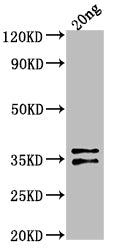 Western Blot
Positive WB detected in Recombinant protein
All lanes: ARCA antibody at 1:2000
Secondary
Goat polyclonal to rabbit IgG at 1/50000 dilution
Predicted band size: 31.4 kDa
Observed band size: 33 kDa