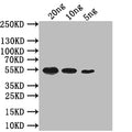 Western Blot
Positive WB detected in: recombinant protein
All lanes: mreB Antibody at 1:1000
Secondary
Goat polyclonal to rabbit IgG at 1/50000 dilution
Predicted band size: 52 kDa
Observed band size: 52 kDa