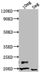 Western Blot
Positive WB detected in Recombinant protein
All lanes: nlpD antibody at 1:2000
Secondary
Goat polyclonal to rabbit IgG at 1/50000 dilution
Predicted band size: 55.29 kDa
Observed band size: 21 kDa