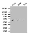 Western Blot
Positive WB detected in: recombinant protein
All lanes: map Antibody at 1:1000
Secondary
Goat polyclonal to rabbit IgG at 1/50000 dilution
Predicted band size: 45 kDa
Observed band size: 45 kDa