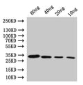 Western Blot
Positive WB detected in: recombinant protein
All lanes:Diphtheria toxin Antibody at 1:1000
Secondary
Goat polyclonal to rabbit IgG at 1/20000 dilution
Predicted band size: 28.6 kDa
Observed band size: 31 kDa