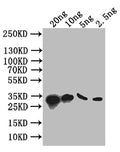 Western Blot
Positive WB detected in: recombinant protein
All lanes: S Antibody at 1:1000
Secondary
Goat polyclonal to rabbit IgG at 1/50000 dilution
Predicted band size: 34 kDa
Observed band size: 34 kDa