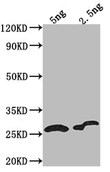 Western Blot
Positive WB detected in Recombinant protein
All lanes: D antibody at 1:2000
Secondary
Goat polyclonal to rabbit IgG at 1/50000 dilution
Predicted band size: 16.21 kDa
Observed band size: 17 kDa
