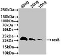 Western Blot
Positive WB detected in: recombinant protein
All lanes: rexB Antibody at 1:1000
Secondary
Goat polyclonal to rabbit IgG at 1/50000 dilution
Predicted band size: 30 kDa
Observed band size: 30 kDa