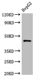 Western Blot
Positive WB detected in: HepG2 whole cell lysate
All lanes: HLA-B antibody at 1:1000
Secondary
Goat polyclonal to rabbit IgG at 1/50000 dilution
Predicted band size: 41 kDa
Observed band size: 45 kDa