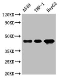 Western Blot
Positive WB detected in: A549 whole cell lysate, THP-1 whole cell lysate, HepG2 whole cell lysate
All lanes: HLA-B antibody at 1:1000
Secondary
Goat polyclonal to rabbit IgG at 1/50000 dilution
Predicted band size: 41 kDa
Observed band size: 45 kDa
