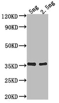 Western Blot
Positive WB detected in Recombinant protein
All lanes: fimA antibody at 1:2000
Secondary
Goat polyclonal to rabbit IgG at 1/50000 dilution
Predicted band size: 31.8 kDa
Observed band size: 36 kDa
