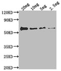 Western Blot
Positive WB detected in Recombinant protein
All lanes: fimH antibody at 1:2000
Secondary
Goat polyclonal to rabbit IgG at 1/50000 dilution
Predicted band size: 59.1 kDa
Observed band size: 59 kDa