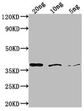 Western Blot
Positive WB detected in Recombinant protein
All lanes: bamA antibody at 1:2000
Secondary
Goat polyclonal to rabbit IgG at 1/50000 dilution
Predicted band size: 36 kDa
Observed band size: 38 kDa