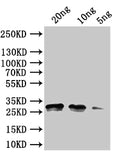 Western Blot
Positive WB detected in: recombinant protein
All lanes:rng Antibody at 1:1000
Secondary
Goat polyclonal to rabbit IgG at 1/50000 dilution
Predicted band size: 30 kDa
Observed band size:30 kDa