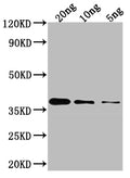Western Blot
Positive WB detected in Recombinant protein
All lanes: GLMU antibody at 1:2000
Secondary
Goat polyclonal to rabbit IgG at 1/50000 dilution
Predicted band size: 37.7 kDa
Observed band size: 35 kDa