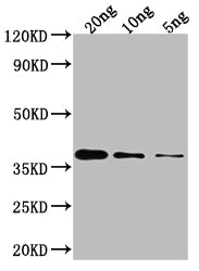 Western Blot
Positive WB detected in Recombinant protein
All lanes: GLMU antibody at 1:2000
Secondary
Goat polyclonal to rabbit IgG at 1/50000 dilution
Predicted band size: 37.7 kDa
Observed band size: 35 kDa