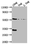 Western Blot
Positive WB detected in Recombinant protein
All lanes: OXYR antibody at 1:2000
Secondary
Goat polyclonal to rabbit IgG at 1/50000 dilution
Predicted band size: 53.6 kDa
Observed band size: 54 kDa