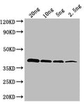 Western Blot
Positive WB detected in: recombinant protein
All lanes: oxyR Antibody at 1:1000
Secondary
Goat polyclonal to rabbit IgG at 1/50000 dilution
Predicted band size: 36 kDa
Observed band size: 36 kDa