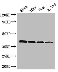 Western Blot
Positive WB detected in: recombinant protein
All lanes: oxyR Antibody at 1:1000
Secondary
Goat polyclonal to rabbit IgG at 1/50000 dilution
Predicted band size: 36 kDa
Observed band size: 36 kDa
