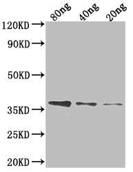 Western Blot
Positive WB detected in Recombinant protein
All lanes: FTSI antibody at 1:2000
Secondary
Goat polyclonal to rabbit IgG at 1/50000 dilution
Predicted band size: 32.4 kDa
Observed band size: 38 kDa