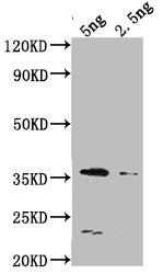 Western Blot
Positive WB detected in Recombinant protein
All lanes: DCM antibody at 1:2000
Secondary
Goat polyclonal to rabbit IgG at 1/50000 dilution
Predicted band size: 36.5 kDa
Observed band size: 34 kDa