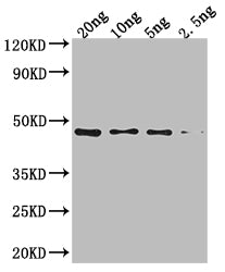 Western Blot
Positive WB detected in Recombinant protein
All lanes: NARX antibody at 1:2000
Secondary
Goat polyclonal to rabbit IgG at 1/50000 dilution
Predicted band size: 40.1 kDa
Observed band size: 44 kDa