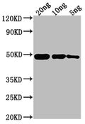 Western Blot
Positive WB detected in Recombinant protein
All lanes: ompF antibody at 1:2000
Secondary
Goat polyclonal to rabbit IgG at 1/50000 dilution
Predicted band size: 44.1 kDa
Observed band size: 49 kDa