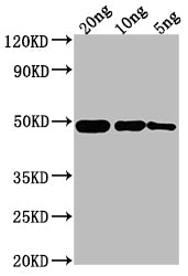 Western Blot
Positive WB detected in Recombinant protein
All lanes: ompF antibody at 1:2000
Secondary
Goat polyclonal to rabbit IgG at 1/50000 dilution
Predicted band size: 44.1 kDa
Observed band size: 49 kDa