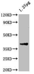 Western Blot
Positive WB detected in: Escherichia coli lysate
All lanes: ompF antibody at 1:2000
Secondary
Goat polyclonal to rabbit IgG at 1/50000 dilution
Predicted band size: 40 kDa
Observed band size: 40 kDa