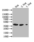 Western Blot
Positive WB detected in: recombinant protein
All lanes: gH Antibody at 1:1000
Secondary
Goat polyclonal to rabbit IgG at 1/50000 dilution
Predicted band size: 38 kDa
Observed band size: 38 kDa