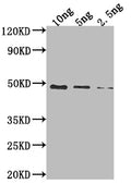 Western Blot
Positive WB detected in Recombinant protein
All lanes: DBP antibody at 1:2000
Secondary
Goat polyclonal to rabbit IgG at 1/50000 dilution
Predicted band size: 43.5 kDa
Observed band size: 49 kDa