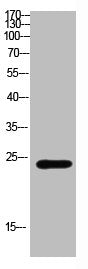 Western Blot analysis of mouse-brain cells using Antibody diluted at 800. Secondary antibody  was diluted at 1:20000